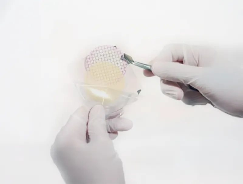 Corrieri Technologies Injection Acide Hyaluronique Bordeaux 29